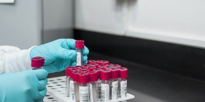 lab-3498584_640